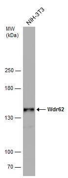 WDR62 Antibody