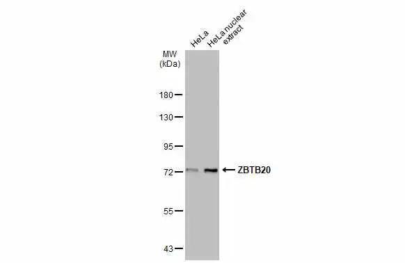 ZBTB20 Antibody - BSA Free