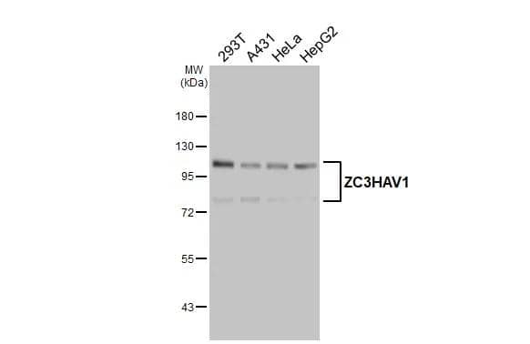 ZCCHV Antibody - BSA Free