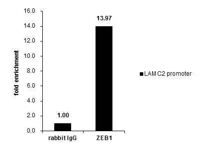ZEB1 Antibody