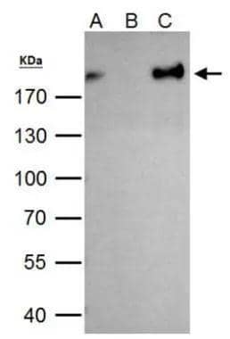ZEB1 Antibody