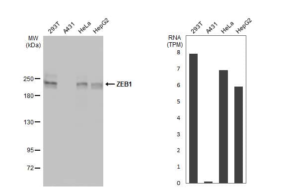 ZEB1 Antibody
