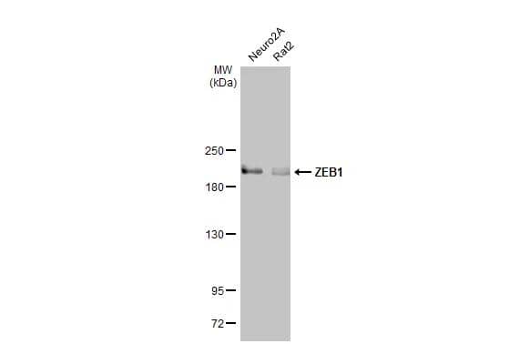 ZEB1 Antibody