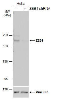 ZEB1 Antibody