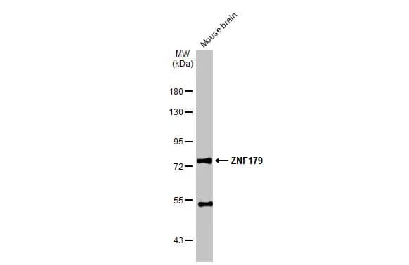 ZNF179 Antibody