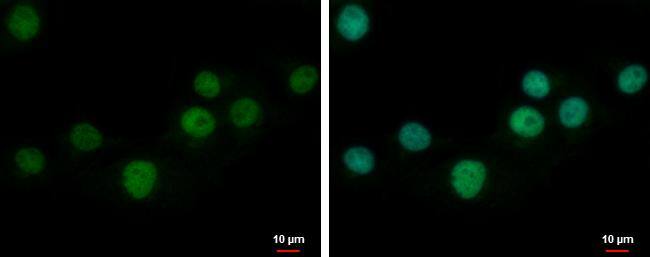 ZNF501 Antibody - BSA Free