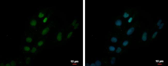 ZNF550 Antibody - BSA Free