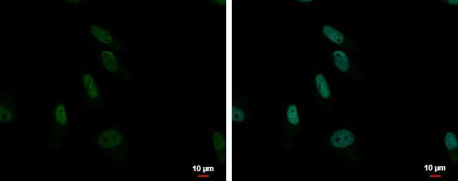 ZNF587 Antibody