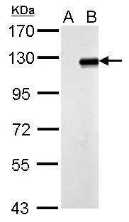 ZNF711 Antibody - BSA Free