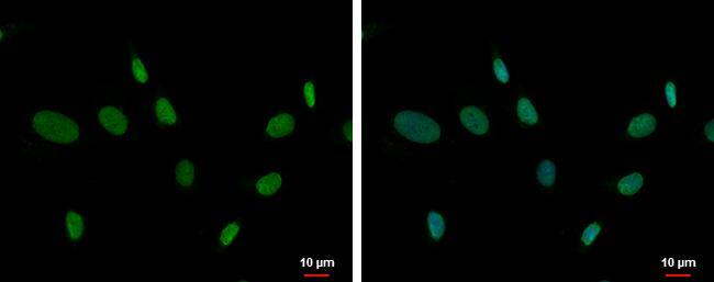 ZNF74 Antibody - BSA Free