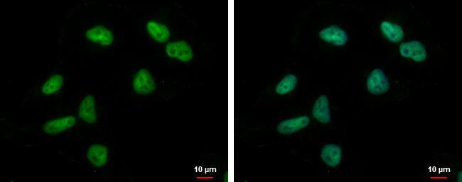 ZNF76 Antibody - BSA Free