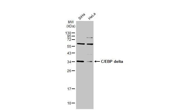CEBP Delta Antibody - BSA Free