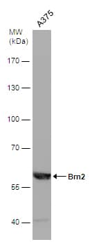 POU3F2/OCT7 Antibody