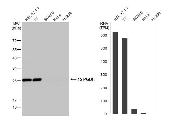 15-PGDH/HPGD Antibody - BSA Free