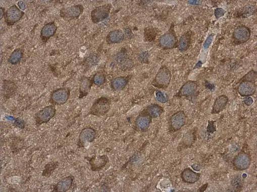 ABAT Antibody - BSA Free