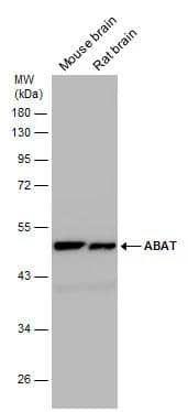 ABAT Antibody - BSA Free