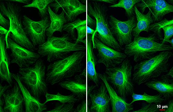 alpha Tubulin 4a Antibody