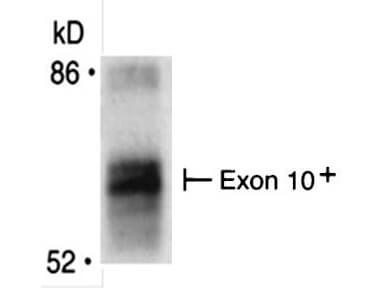 BIN1 Antibody (99F)