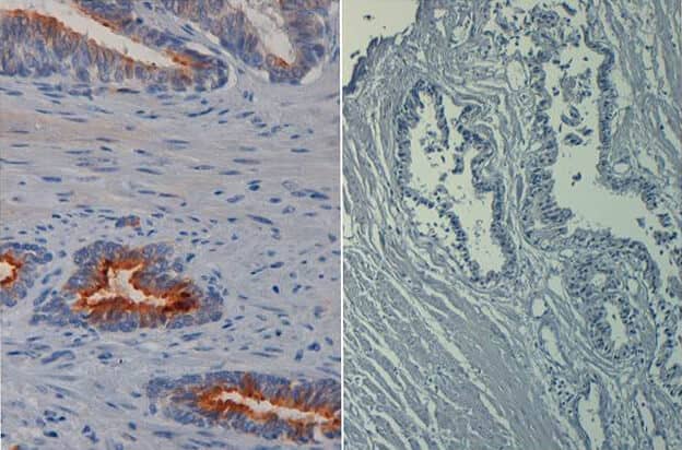 AKT1 [p Ser473] Antibody (17F6.B11) [Biotin]
