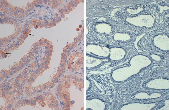 AKT1 [p Ser473] Antibody (17F6.B11) [Biotin]