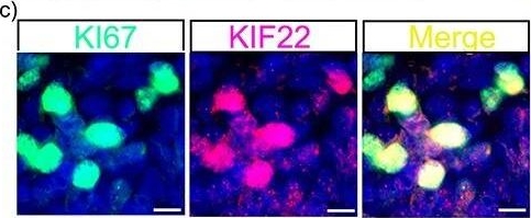 Ki67/MKI67 Antibody (8D5) - BSA Free