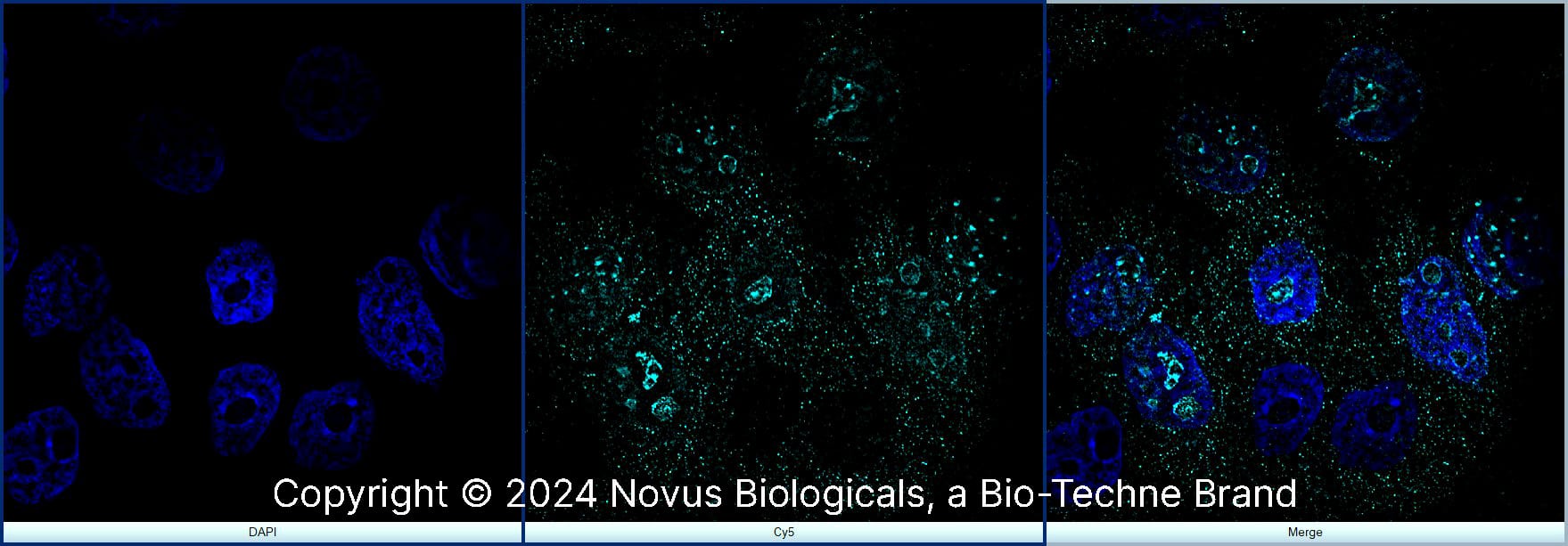 Ki67/MKI67 Antibody (8D5) [Alexa Fluor® 647]