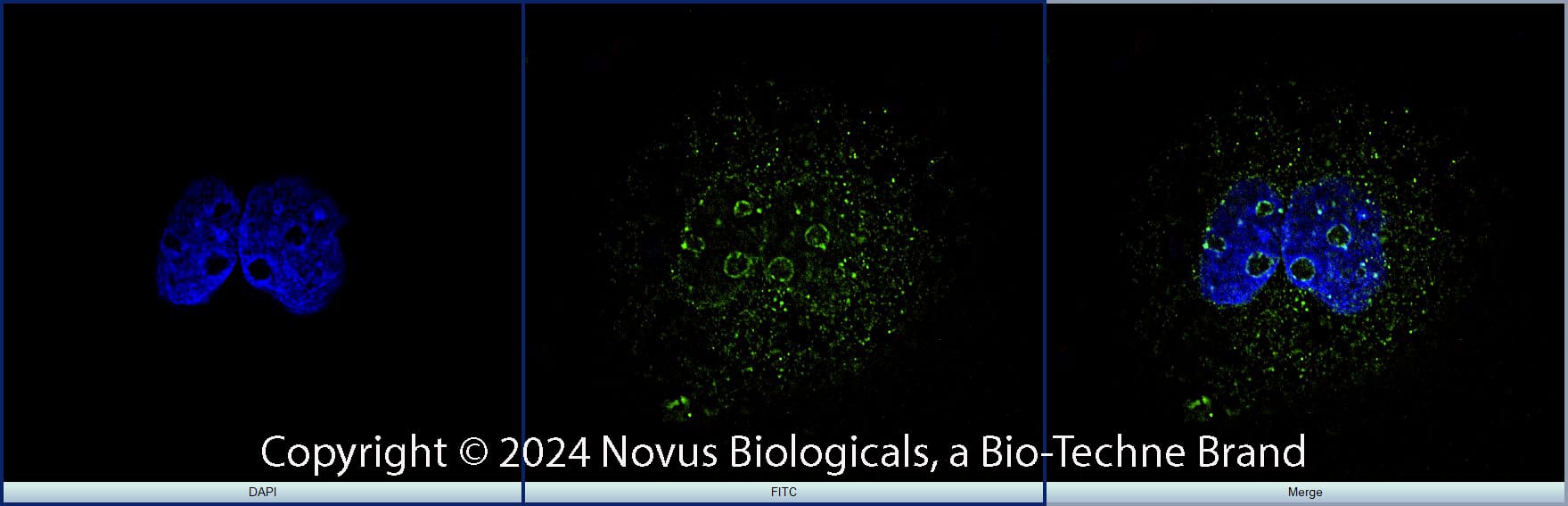 Ki67/MKI67 Antibody (8D5) [FITC]