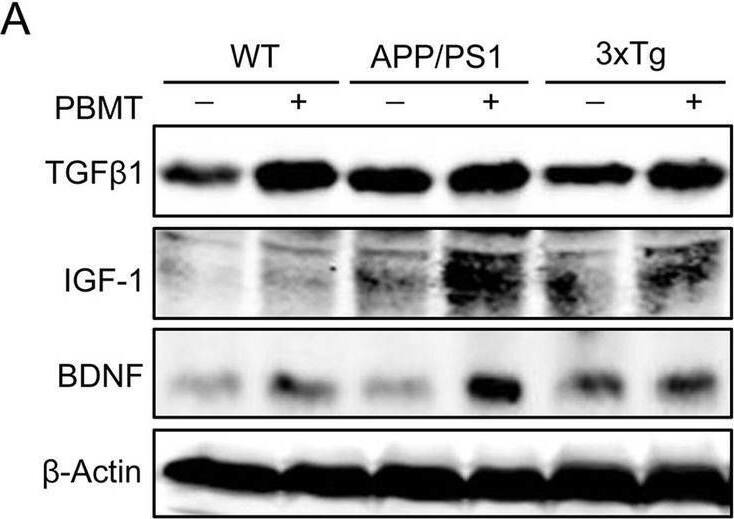 LAP (TGF-beta 1) Antibody (7F6) - BSA Free