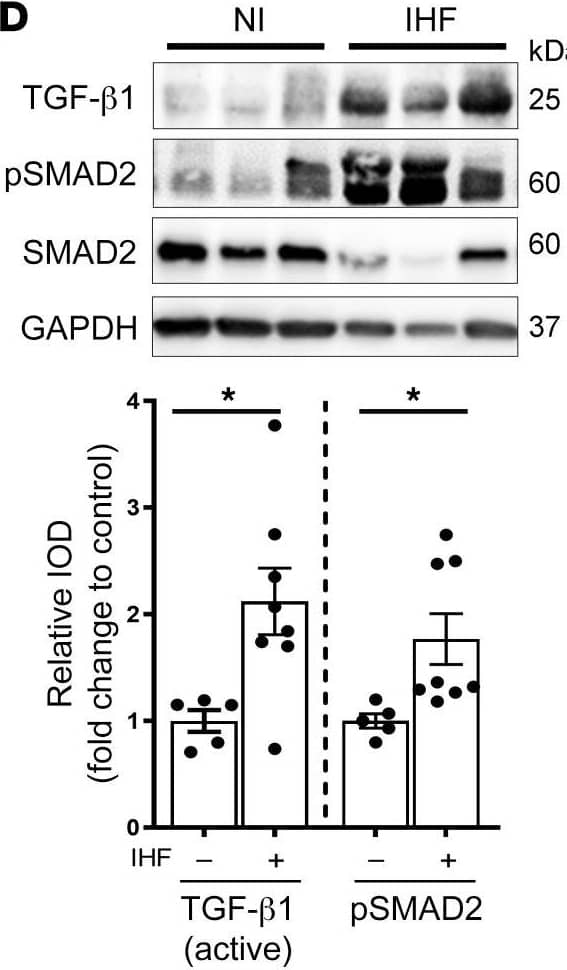 LAP (TGF-beta 1) Antibody (7F6) - BSA Free
