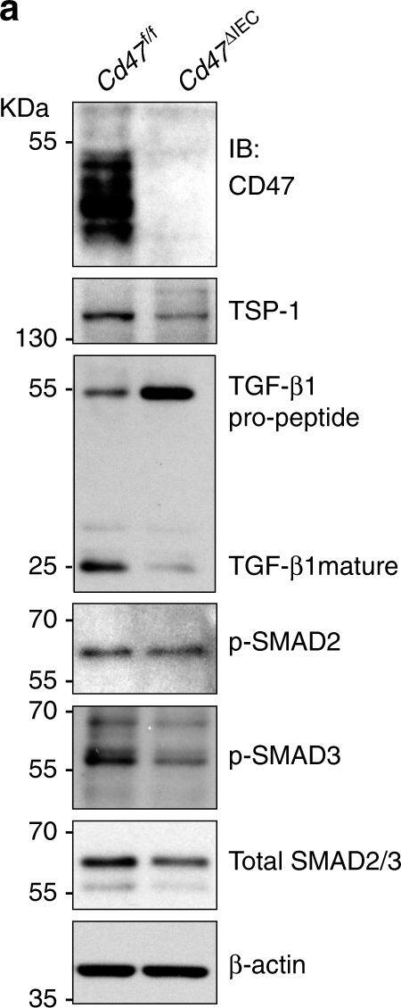 LAP (TGF-beta 1) Antibody (7F6) - BSA Free