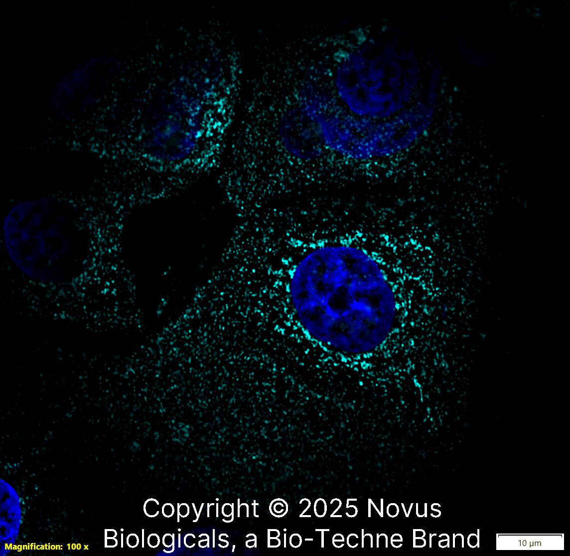 LAMP-2/CD107b Antibody (H4B4) [Alexa Fluor® 647]