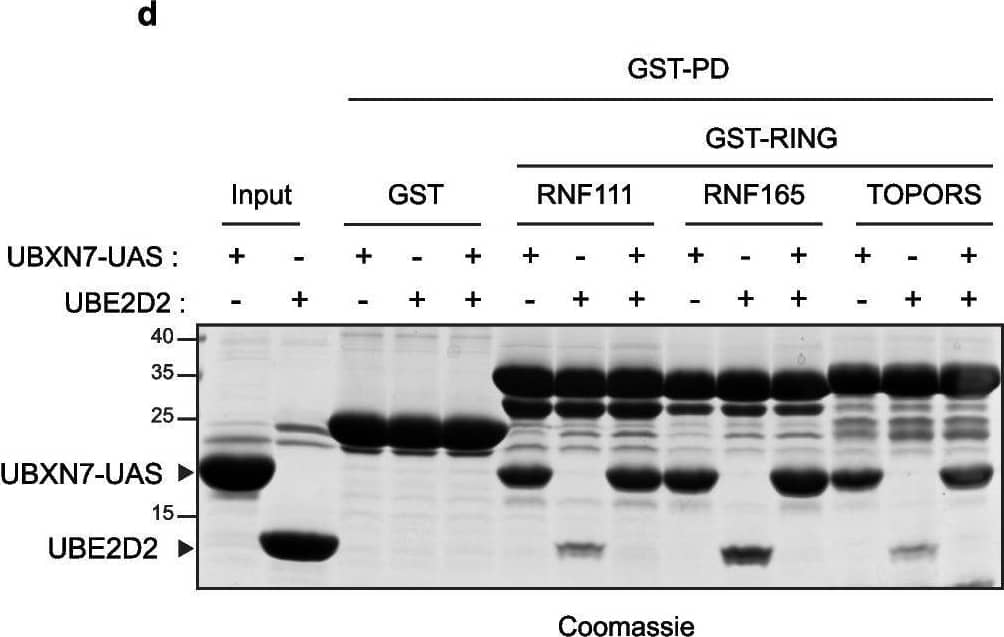 UBXN7 Antibody - BSA Free