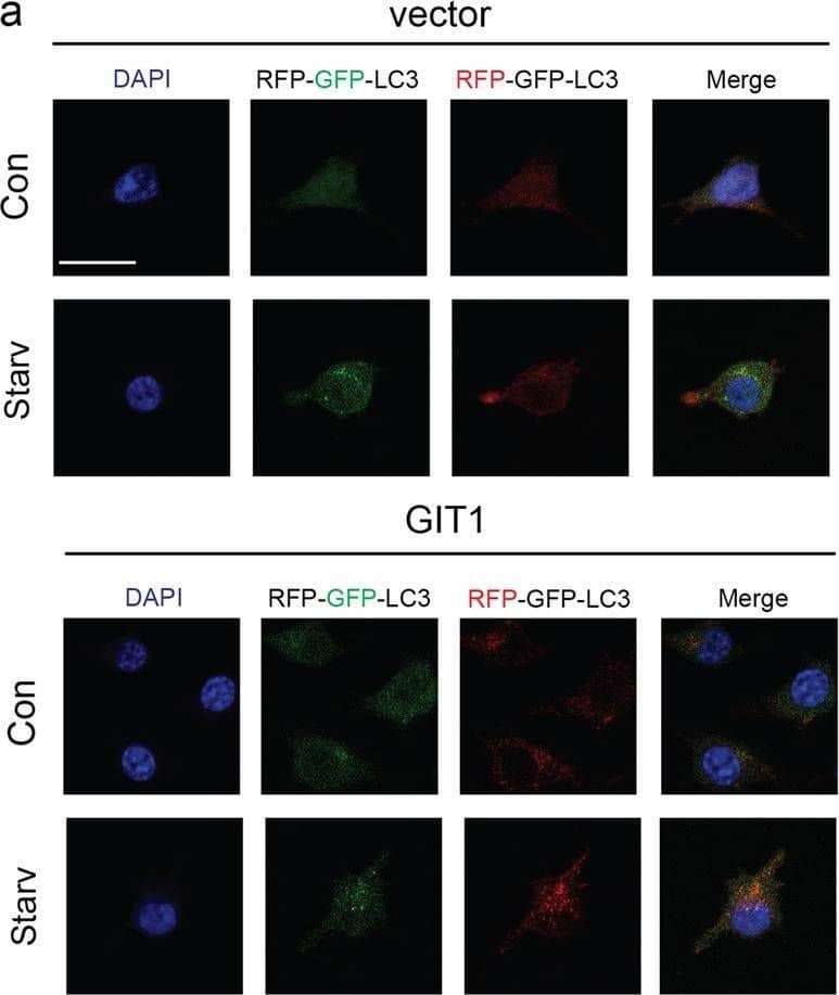 GIT1 Antibody (S39B-8) - BSA Free