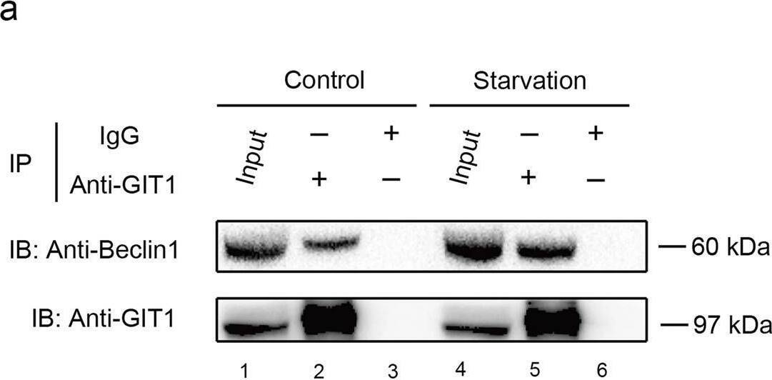 GIT1 Antibody (S39B-8) - BSA Free