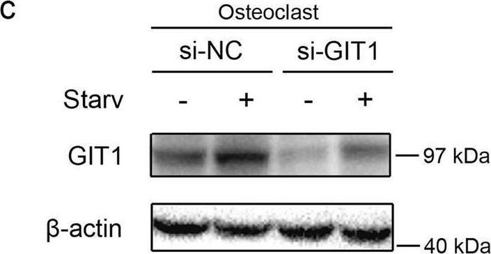 GIT1 Antibody (S39B-8) - BSA Free