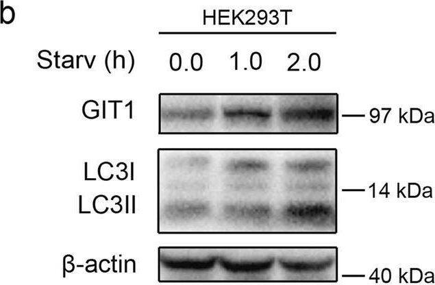 GIT1 Antibody (S39B-8) - BSA Free