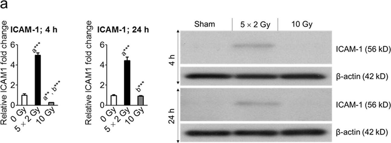 ICAM-1/CD54 Antibody (1A29)