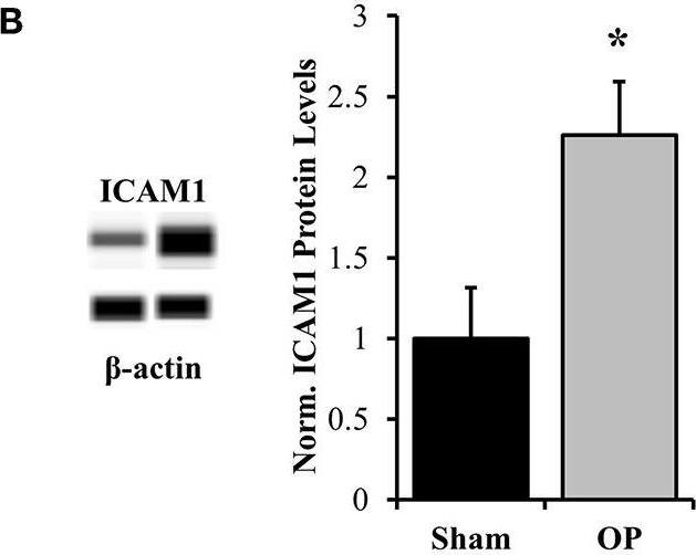ICAM-1/CD54 Antibody (1A29)