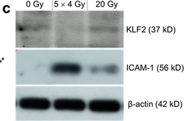 ICAM-1/CD54 Antibody (1A29)