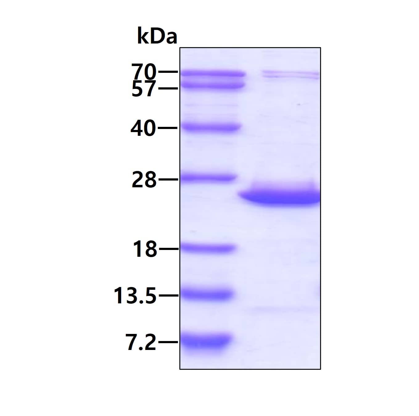 Recombinant Human BCL2L10 His Protein