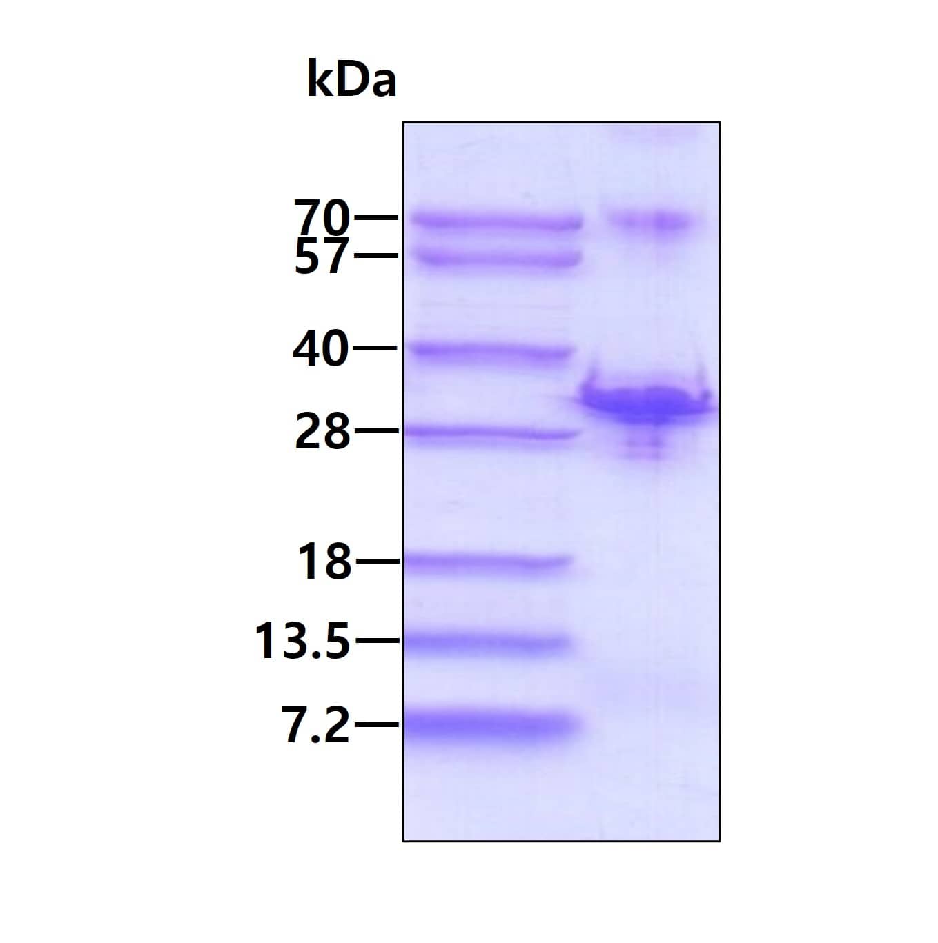 Recombinant Human CHMP1a His Protein SDS-Page: CHMP1a Protein [NBP2-22770]