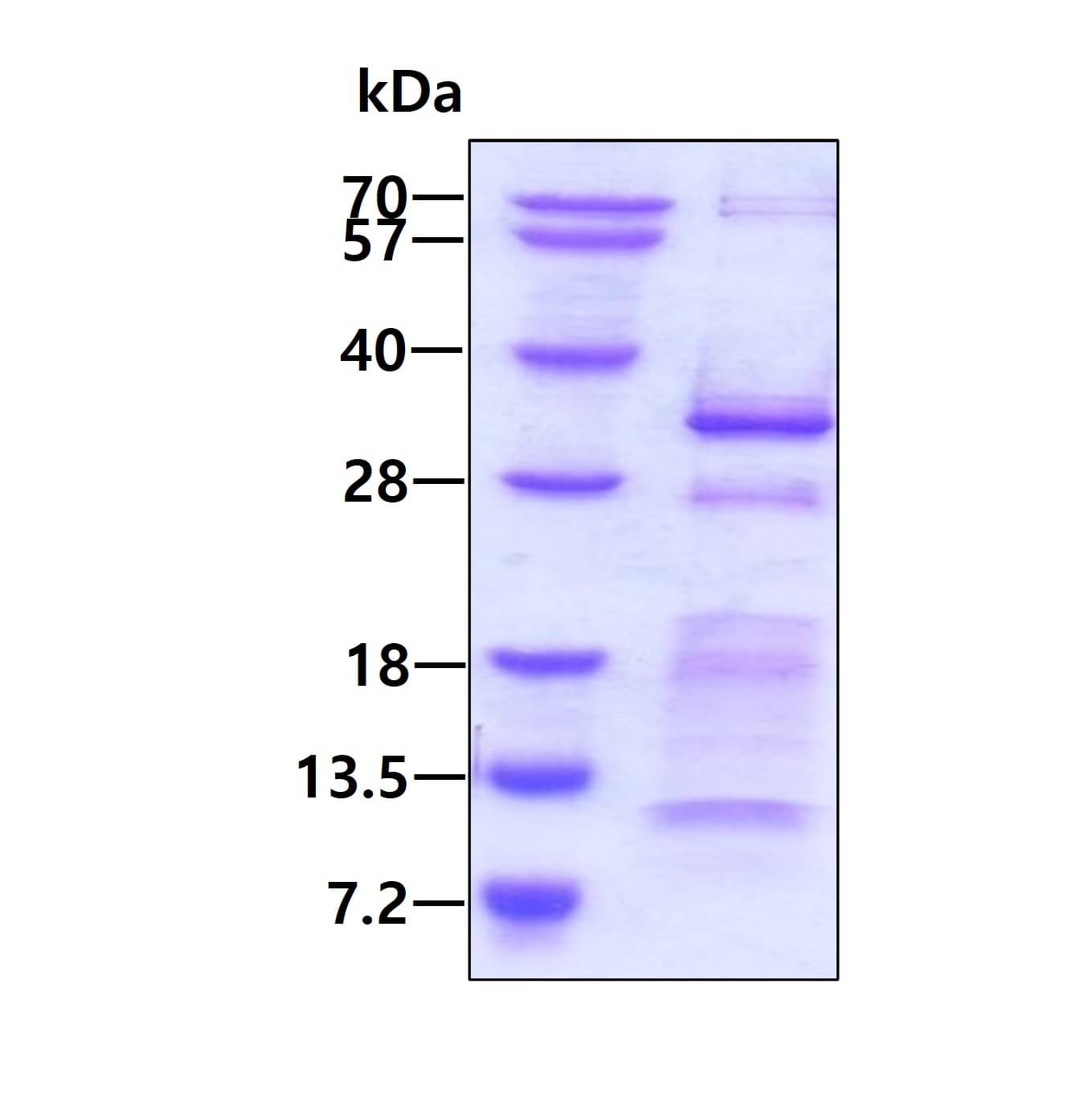 Recombinant Human CHMP5 His Protein