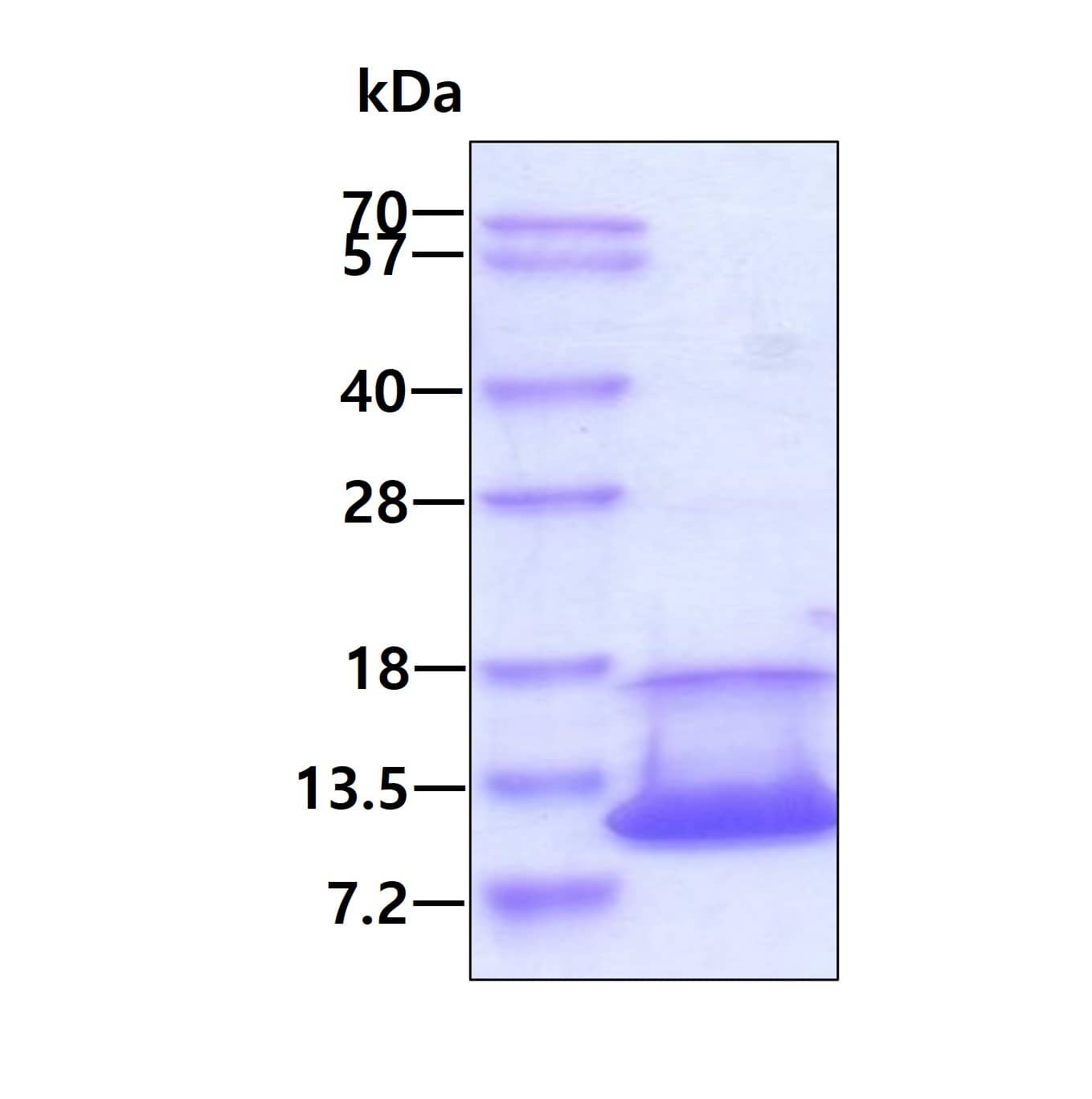 Recombinant Human CNP/NPPC His Protein SDS-Page: Recombinant Human CNP/NPPC Protein [NBP2-23271]