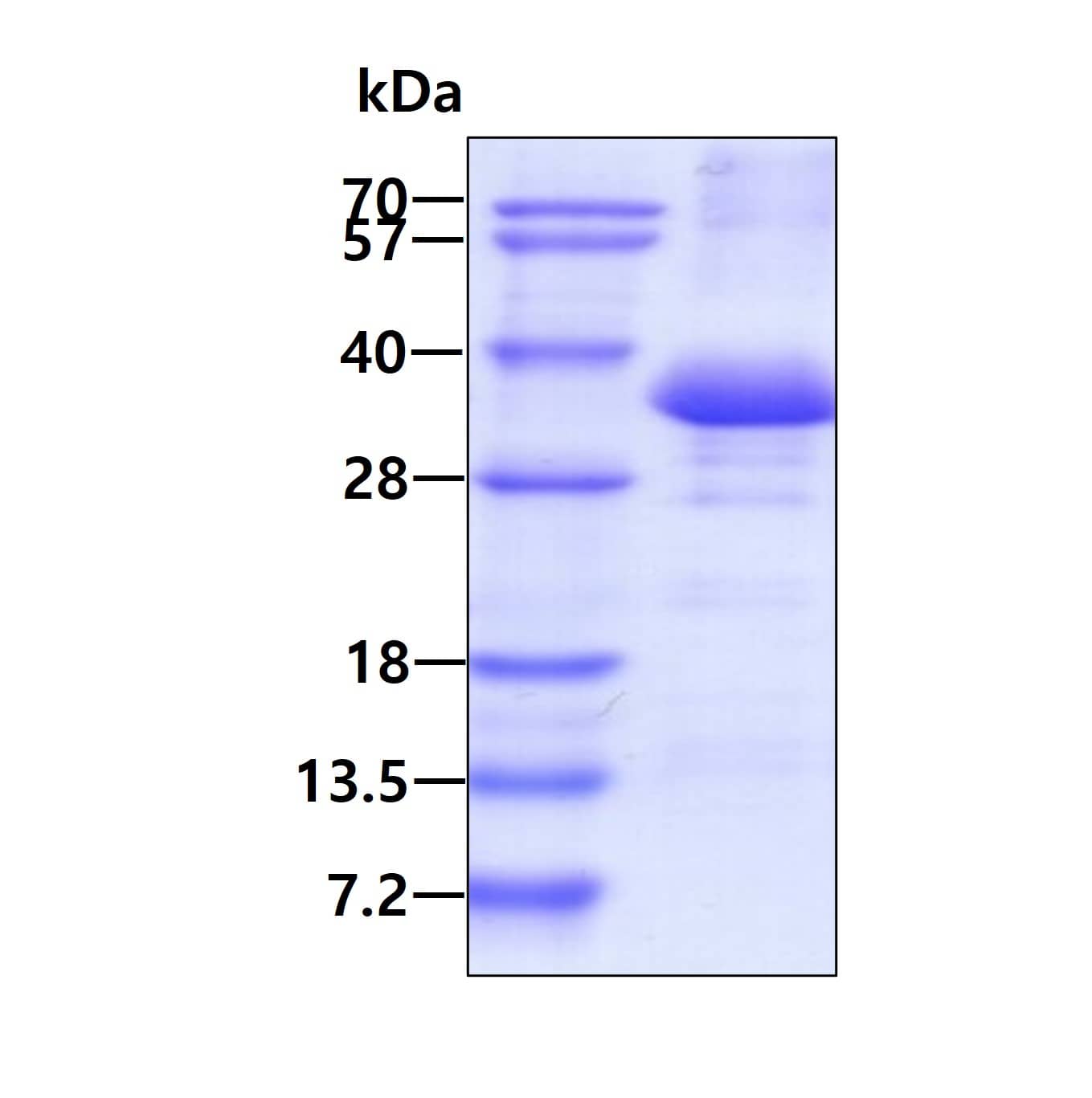 Recombinant Human Phospholipid Scramblase 1/PLSCR1 His Protein