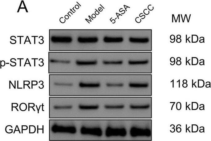 ROR gamma/RORC/NR1F3 Antibody - BSA Free
