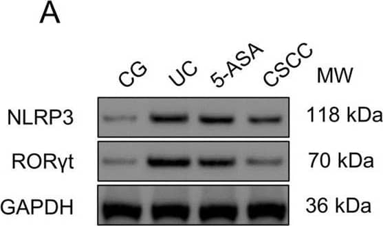 ROR gamma/RORC/NR1F3 Antibody - BSA Free