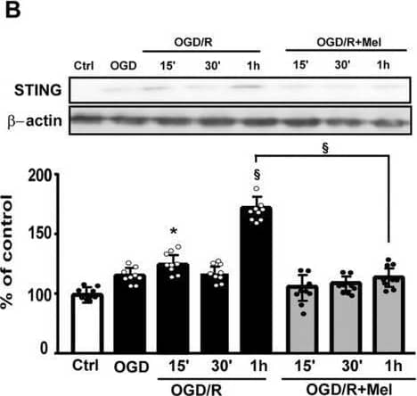 STING/TMEM173 Antibody - BSA Free