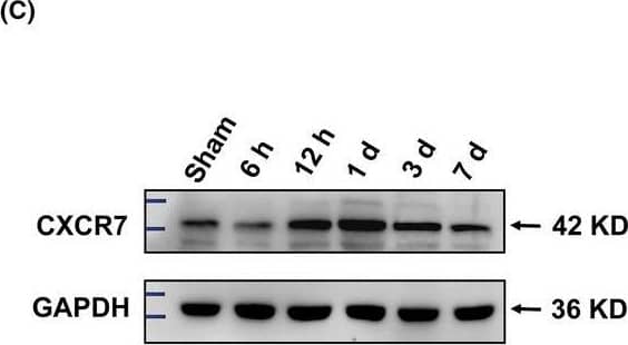 CXCR7/RDC-1 Antibody - BSA Free