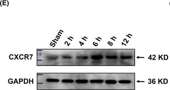 CXCR7/RDC-1 Antibody - BSA Free