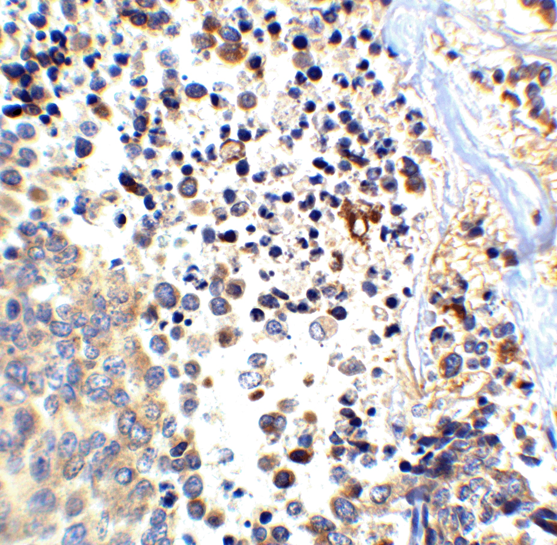 beta Amyloid Antibody - BSA Free